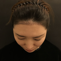 發(fā)際線用戶圖片