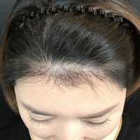 發(fā)際線用戶圖片