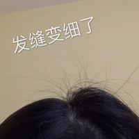 發(fā)際線用戶圖片