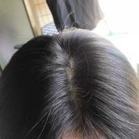 發(fā)際線用戶圖片