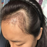發(fā)際線用戶圖片