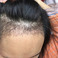 發(fā)際線用戶圖片