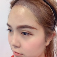 發(fā)際線用戶圖片