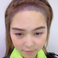 發(fā)際線用戶圖片