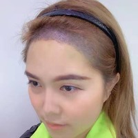 發(fā)際線用戶圖片