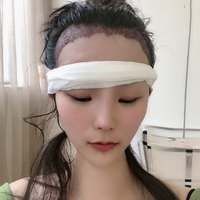 發(fā)際線用戶圖片