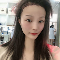 發(fā)際線用戶圖片