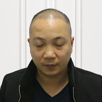 發(fā)際線用戶圖片