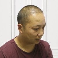 發(fā)際線用戶圖片