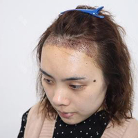 發(fā)際線用戶圖片