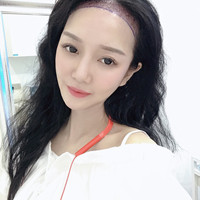 發(fā)際線用戶圖片