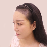 發(fā)際線用戶圖片